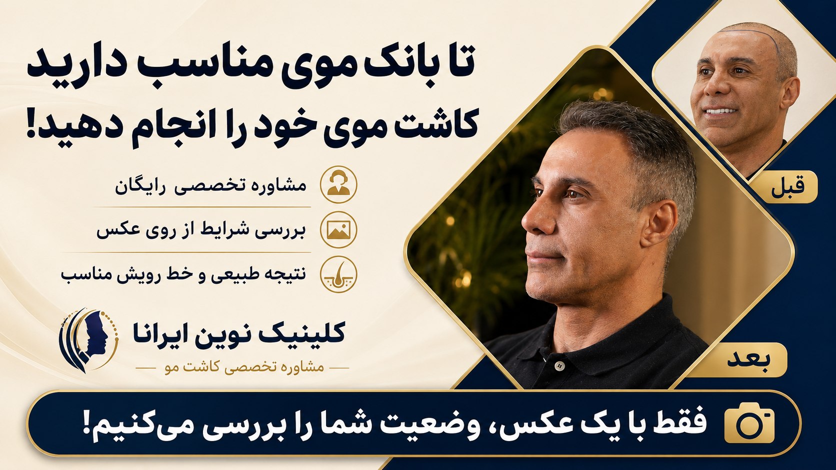 درمانگاه کاشت مو نوین ایرانا