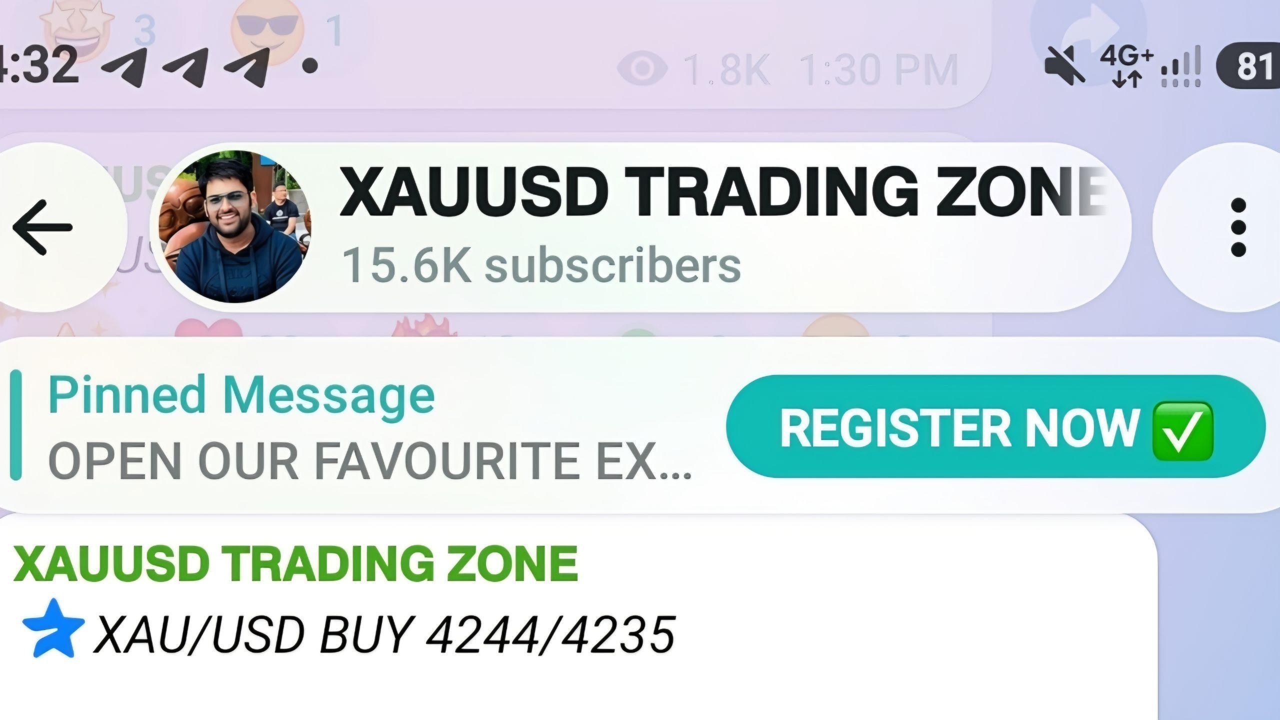 𝗫𝗔𝗨𝗨𝗦𝗗 𝗧𝗥𝗔𝗗𝗜𝗡𝗚 𝗭𝗢𝗡𝗘