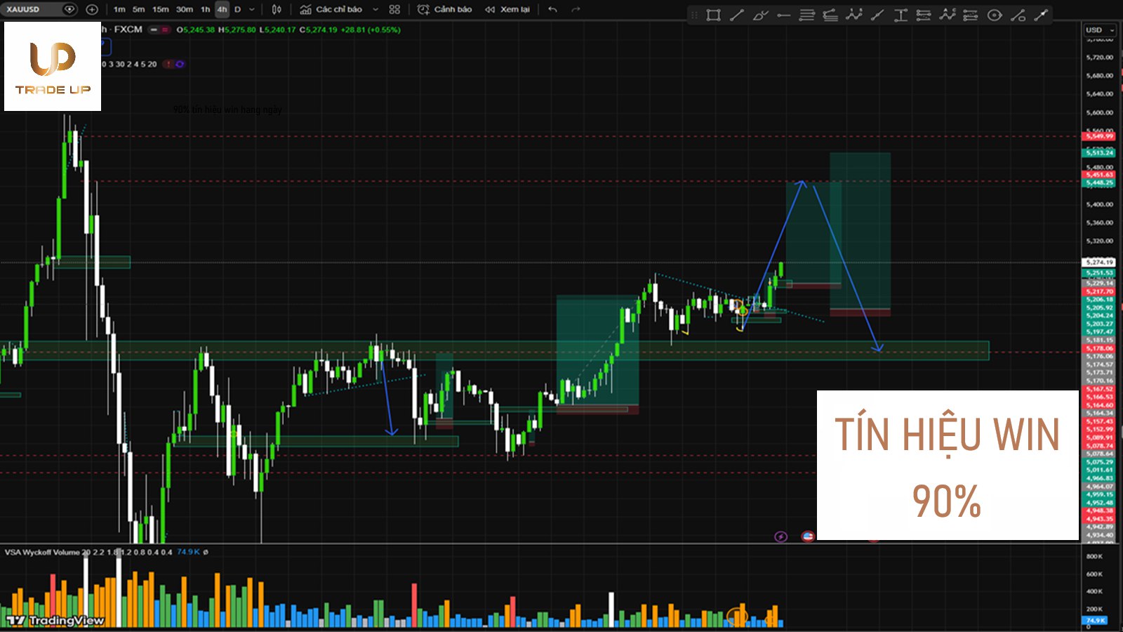 Trade Up- Xau